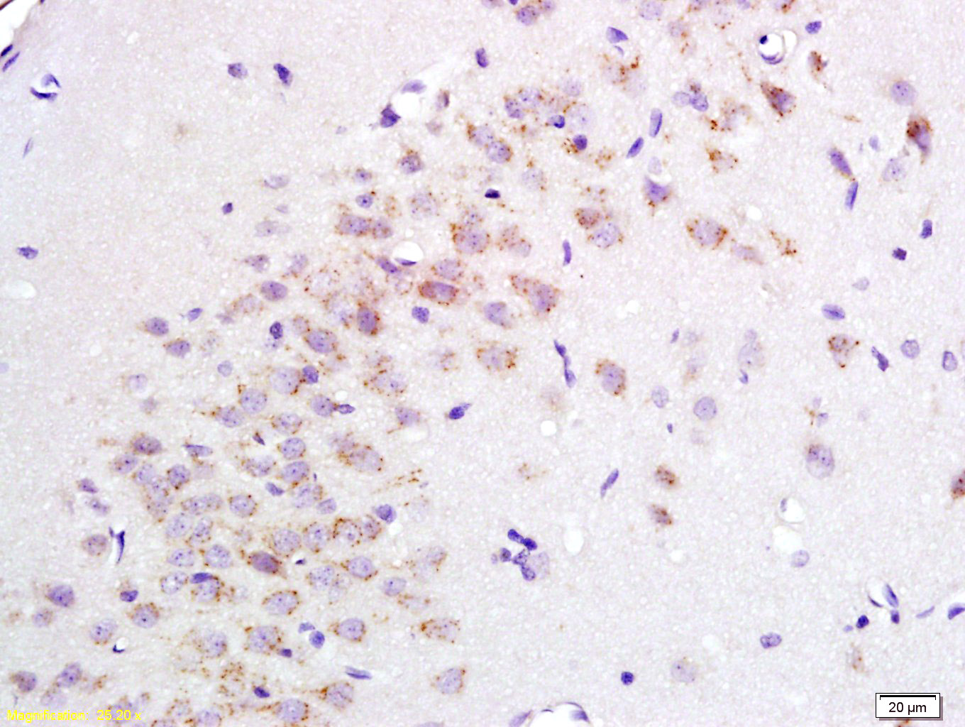 PENK Rabbit pAb (一抗) - IHC-P,IHC-F,IF | Bioss