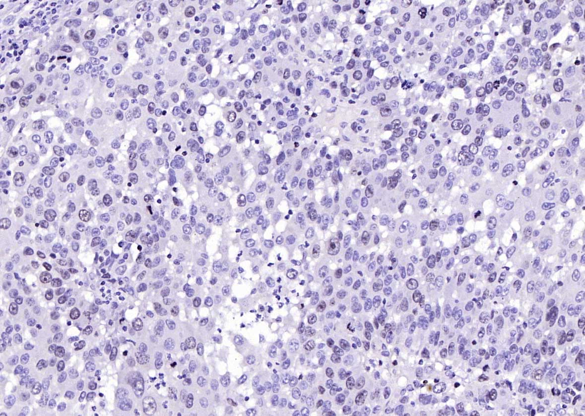Ki-67 Rabbit pAb (一抗) - WB,IHC-P,IHC-F,IF,Flow-Cyt,ICC/IF | Bioss