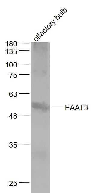 EAAT3 Rabbit pAb (一抗) | Bioss