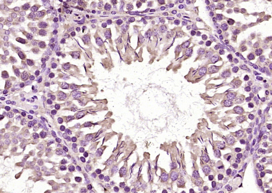 RSPO1 Rabbit pAb (一抗) | Bioss