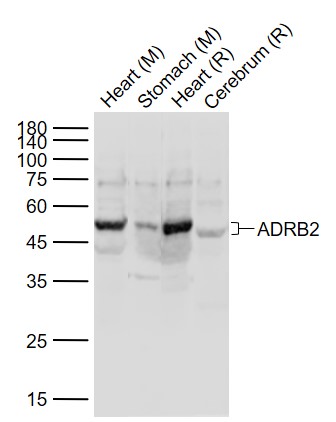ADRB2 Rabbit pAb (一抗) | Bioss