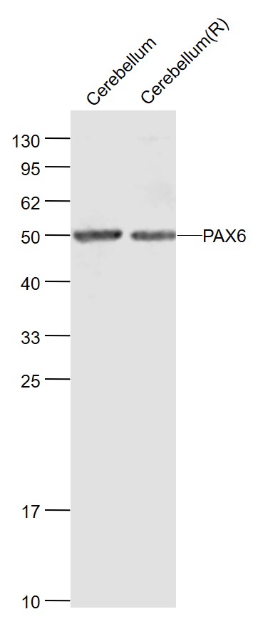 PAX6 Rabbit pAb (一抗) | Bioss