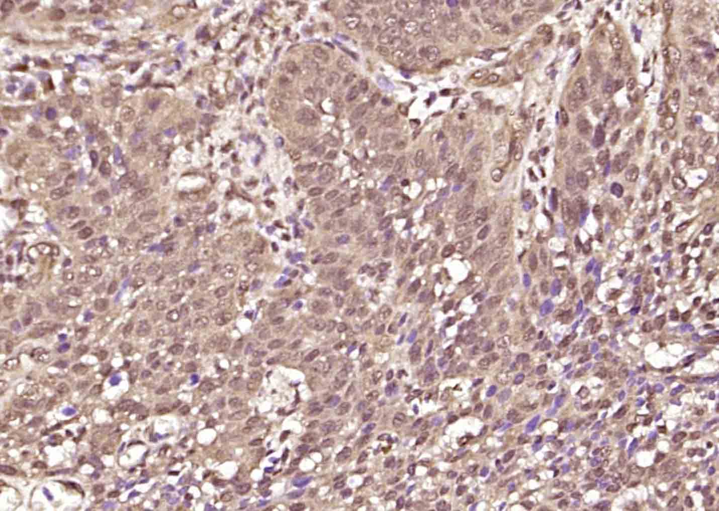 磷酸化信号转导和转录激活因子3抗体-bs-22386R