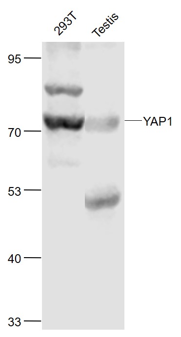 YAP1 Rabbit pAb (一抗) | Bioss