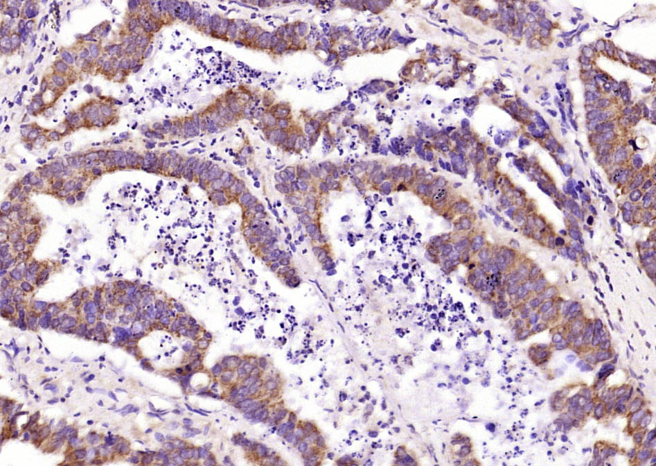 KB抑制蛋白激酶γ抗体-bs-22575R