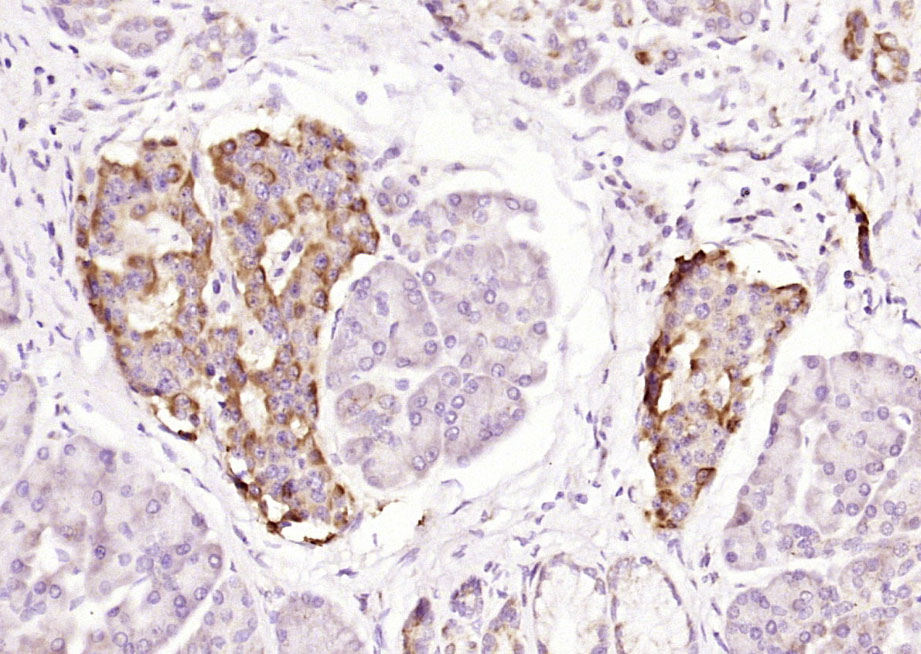 KB抑制蛋白激酶γ抗体-bs-22575R