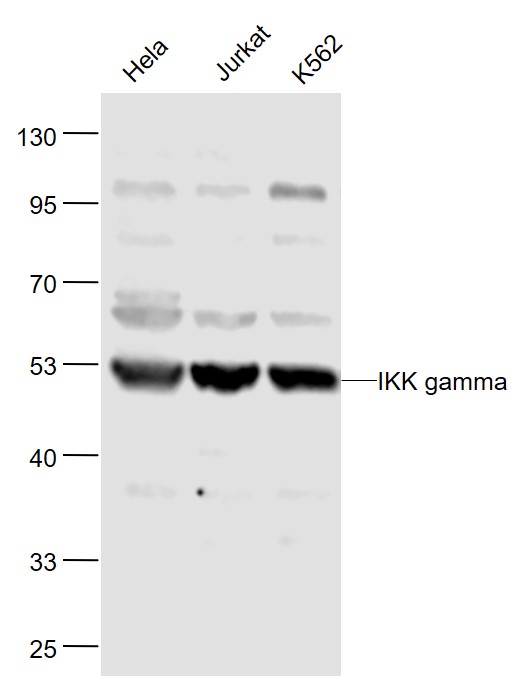 IKK gamma Rabbit pAb (一抗) | Bioss