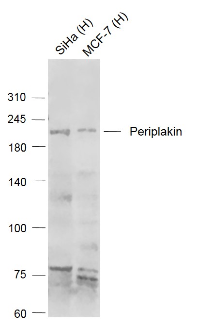 Periplakin Rabbit pAb (一抗) | Bioss