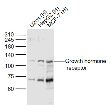 Growth hormone receptor Rabbit pAb (一抗) | Bioss