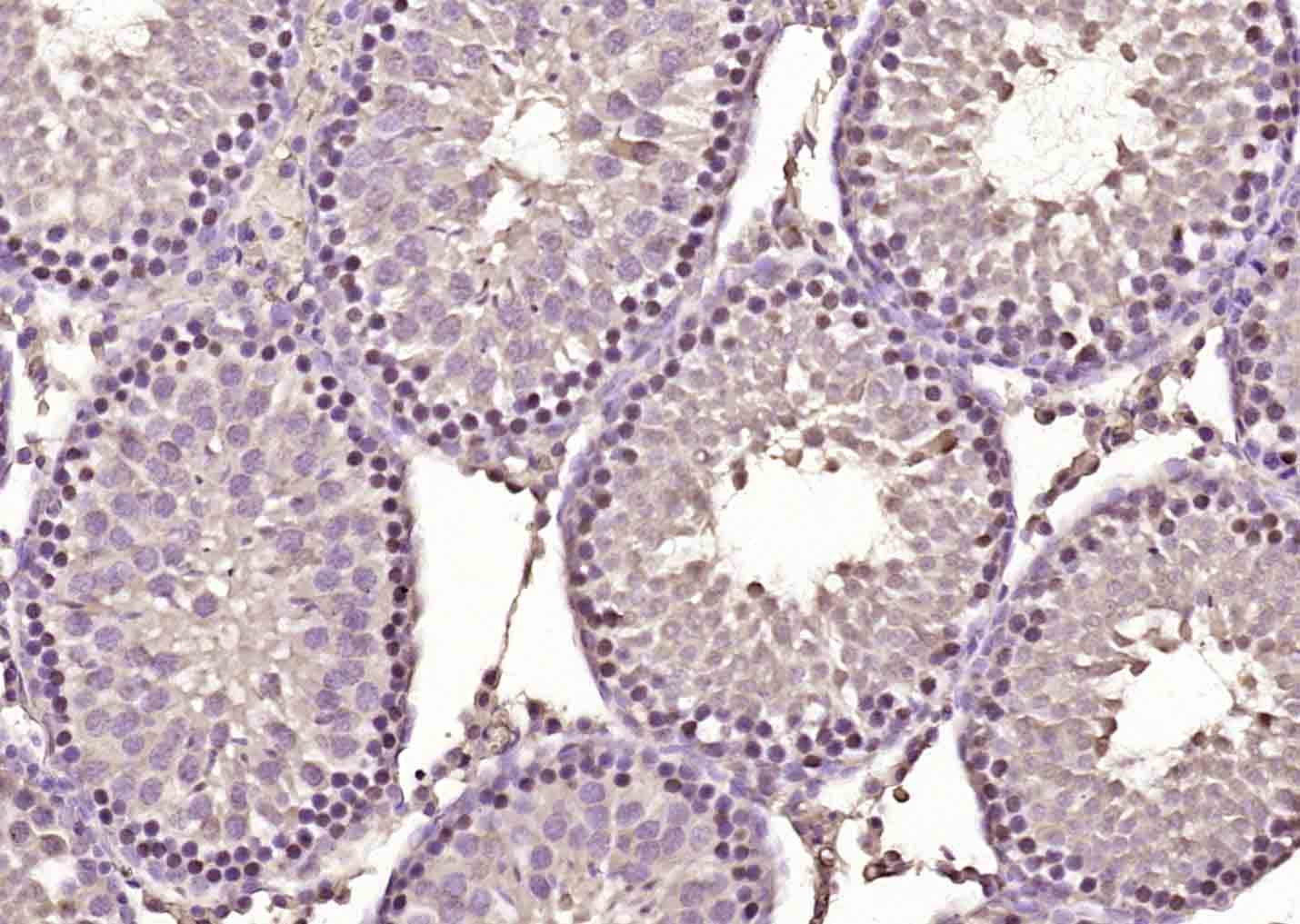 泛素交联酶抗体-bs-2305R