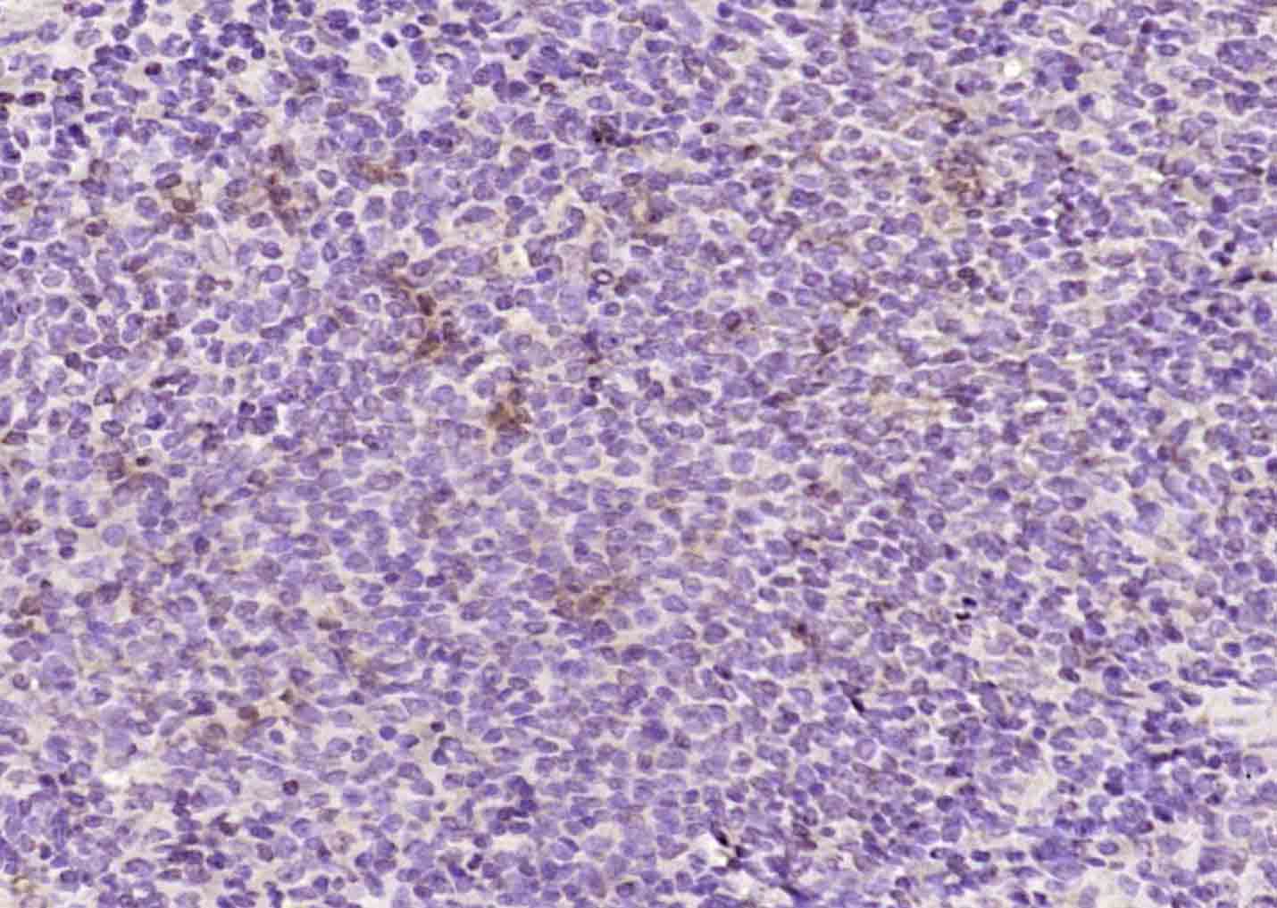 泛素交联酶抗体-bs-2305R