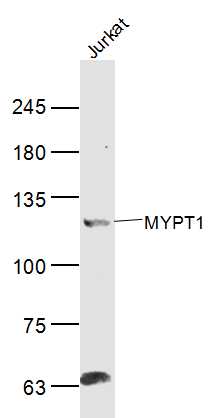 MYPT1 Rabbit pAb (一抗) | Bioss