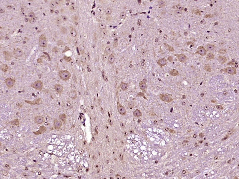 肌球蛋白磷酸酶抗体-bs-23290R