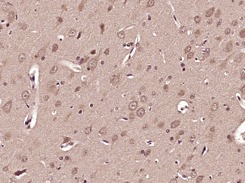 γ谷氨酰半胱氨酸合成酶抗体-bs-23393R