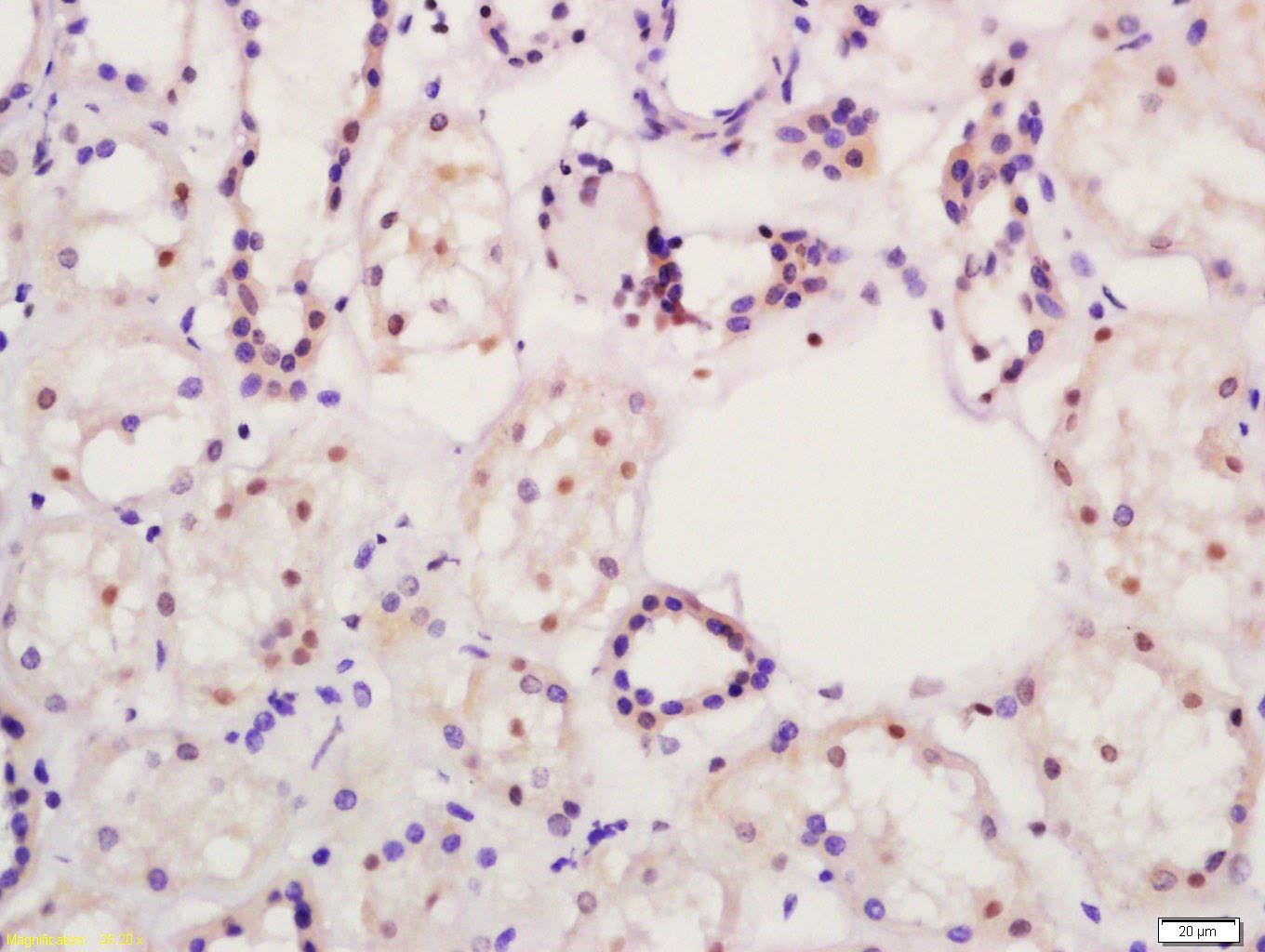 α型-过氧化酶活化增生受体抗体-bs-23398R