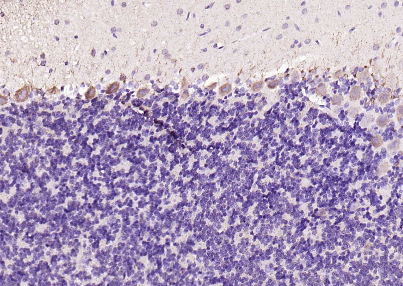 天冬酰胺合成酶抗体-bs-23431R