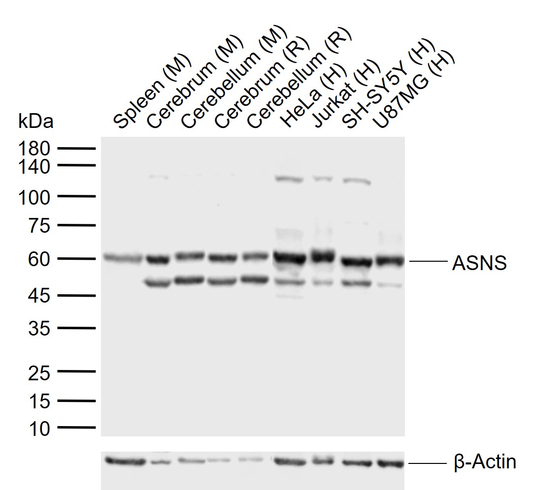 ASNS Rabbit pAb (一抗) | Bioss