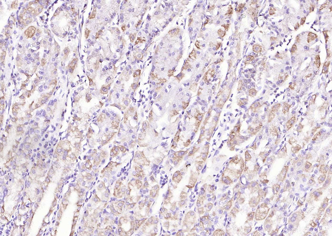 天冬酰胺合成酶抗体-bs-23431R