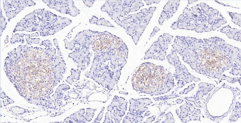 天冬酰胺合成酶抗体-bs-23431R