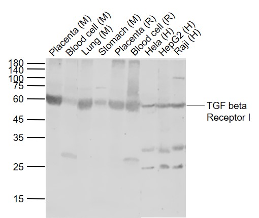 TGF beta Receptor I Rabbit pAb (一抗) | Bioss