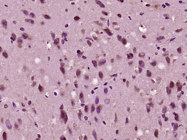 ADAMTS10 Rabbit pAb (一抗) | Bioss