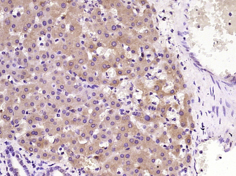 Neutrophil Elastase Rabbit pAb (一抗) | Bioss
