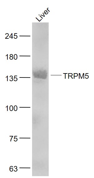 TRPM5 Rabbit pAb (一抗) | Bioss