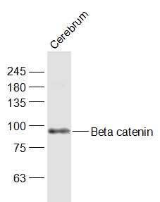 Beta catenin Rabbit pAb (一抗) | Bioss
