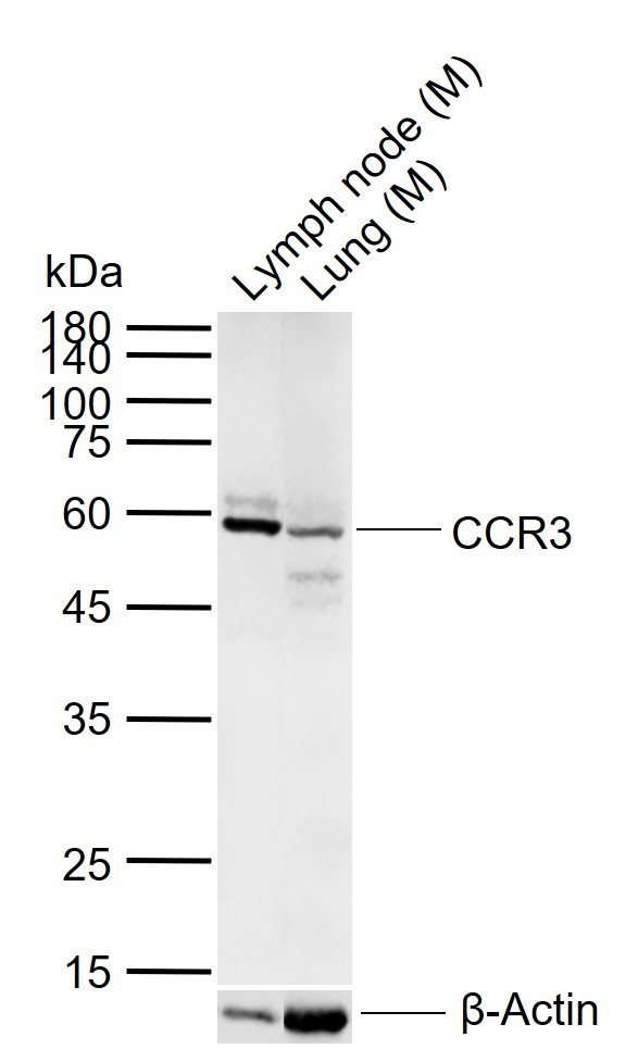 CCR3 Rabbit pAb (一抗) | Bioss