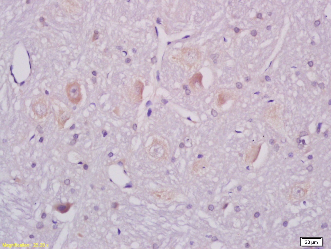 GM1 Rabbit pAb (一抗) - IHC-P,IHC-F,IF,Flow-Cyt | Bioss