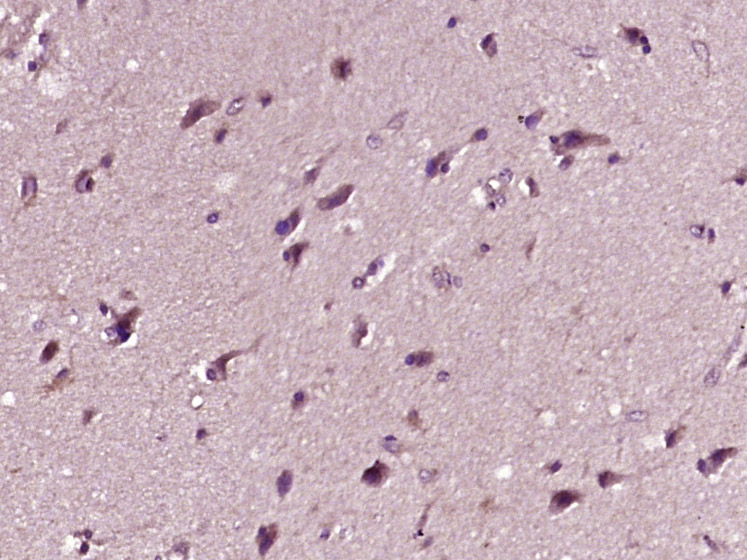 帕金蛋白抗体-bs-23687R