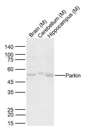 Parkin Rabbit pAb (一抗) | Bioss