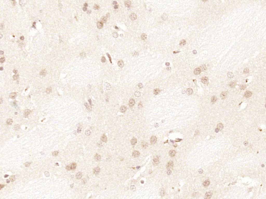 抑癌基因p16抗体-bs-23797R