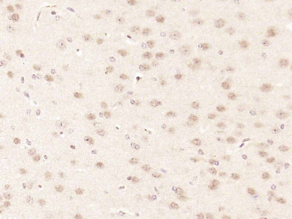 CDKN2A/p16-INK4a Rabbit pAb (一抗) - IHC-P,IHC-F,IF | Bioss