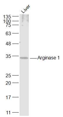Arginase 1 Rabbit pAb (一抗) | Bioss