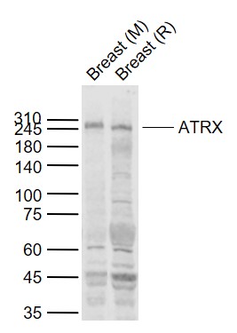 ATRX Rabbit pAb (一抗) | Bioss