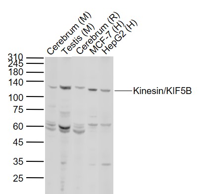 KIF5B Rabbit pAb (一抗) | Bioss