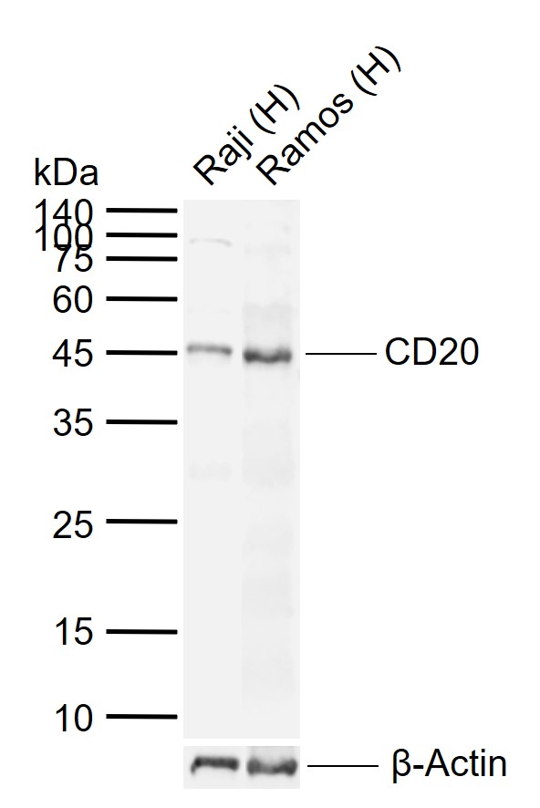 CD20 Rabbit pAb (一抗) - WB | Bioss