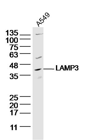 LAMP3 Rabbit pAb (一抗) | Bioss