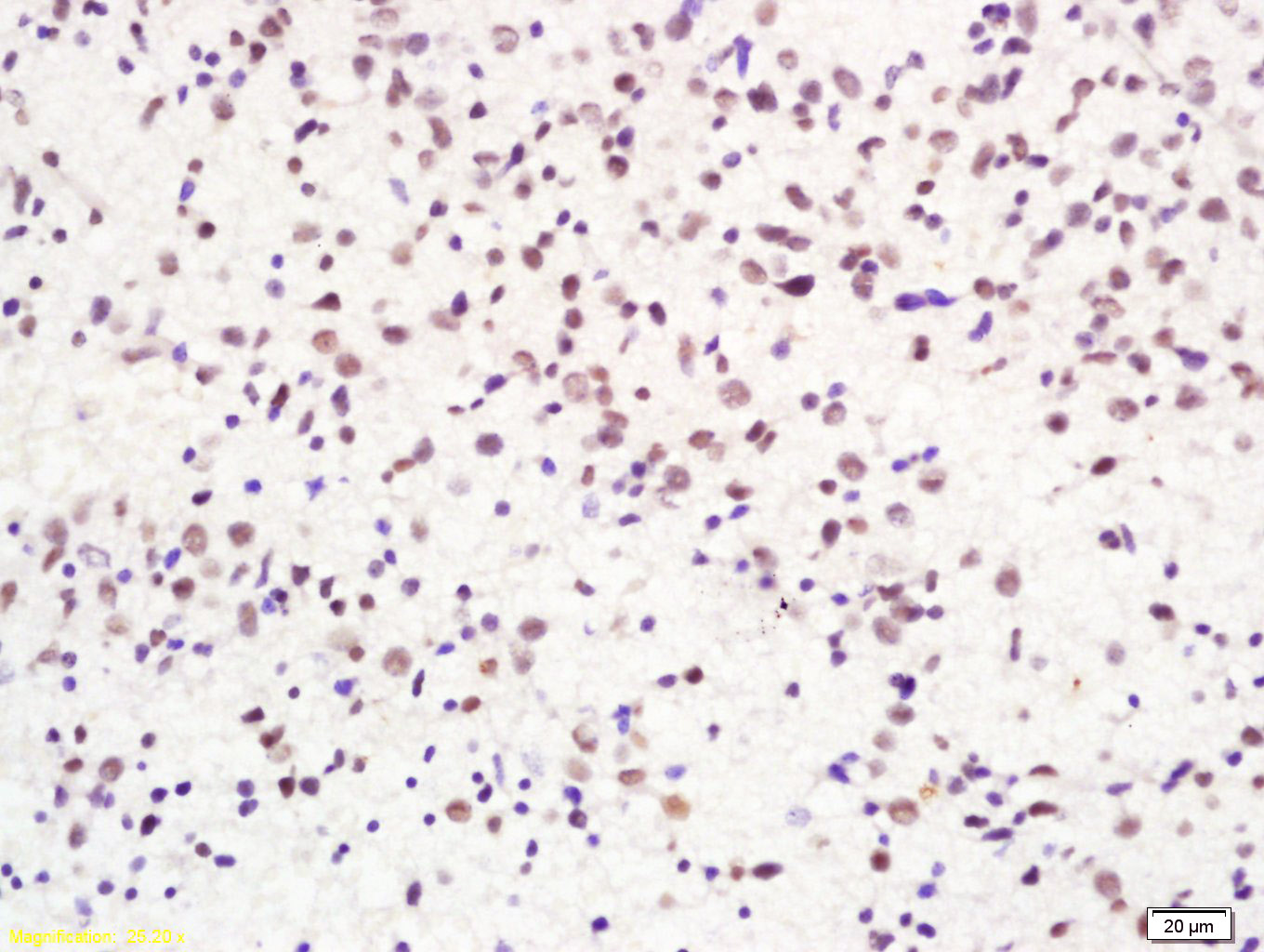 组蛋白H2AX抗体-bs-2560R