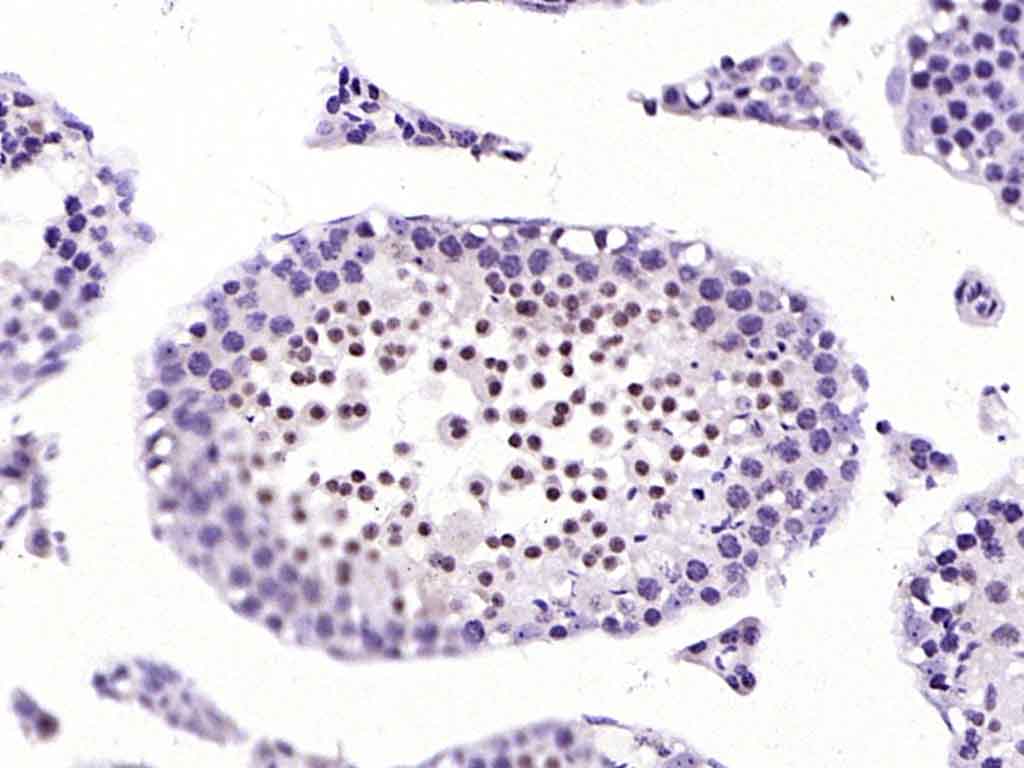 组蛋白H2AX抗体-bs-2560R