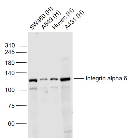 Integrin alpha 6 Rabbit pAb (一抗) | Bioss