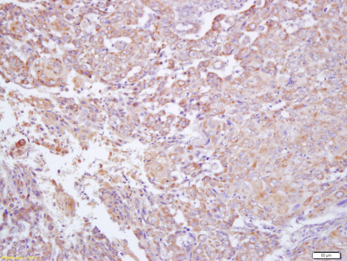 干扰素-gamma受体2/干扰素-gamma受体β/IFN-γRβ抗体-bs-2710R