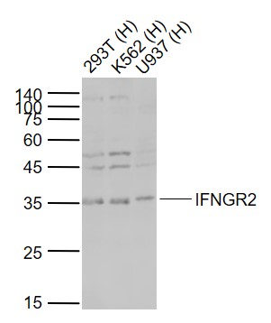 IFNGR2 Rabbit pAb (一抗) | Bioss