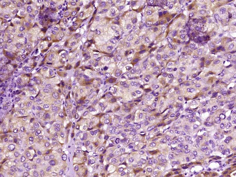 BCL10 Rabbit pAb (一抗) - IHC-P,IHC-F,IF,Flow-Cyt,ICC/IF | Bioss
