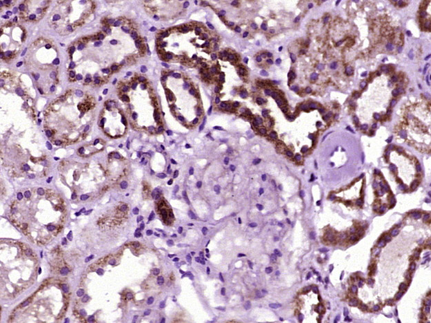 ACACA Rabbit pAb (一抗) | Bioss