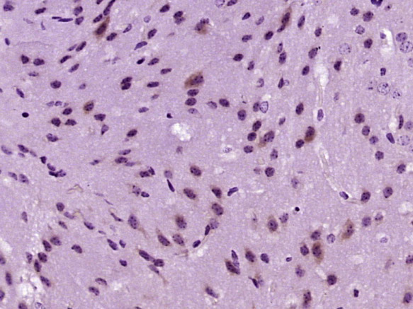 乙酰辅酶A羧化酶抗体-bs-2745R