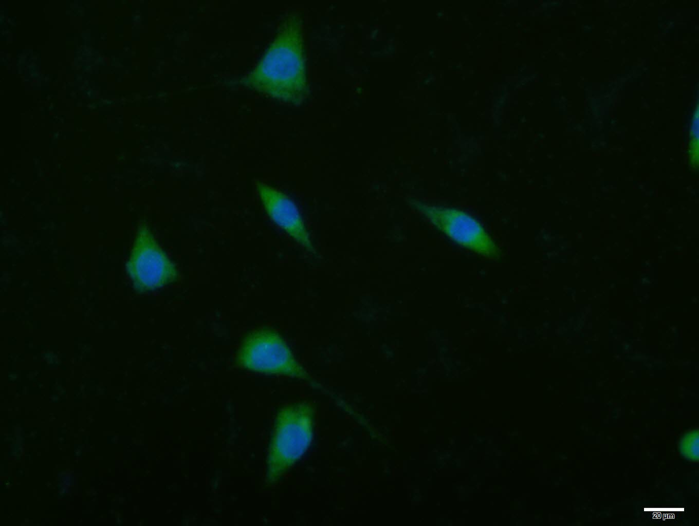 乙酰辅酶A羧化酶抗体-bs-2745R