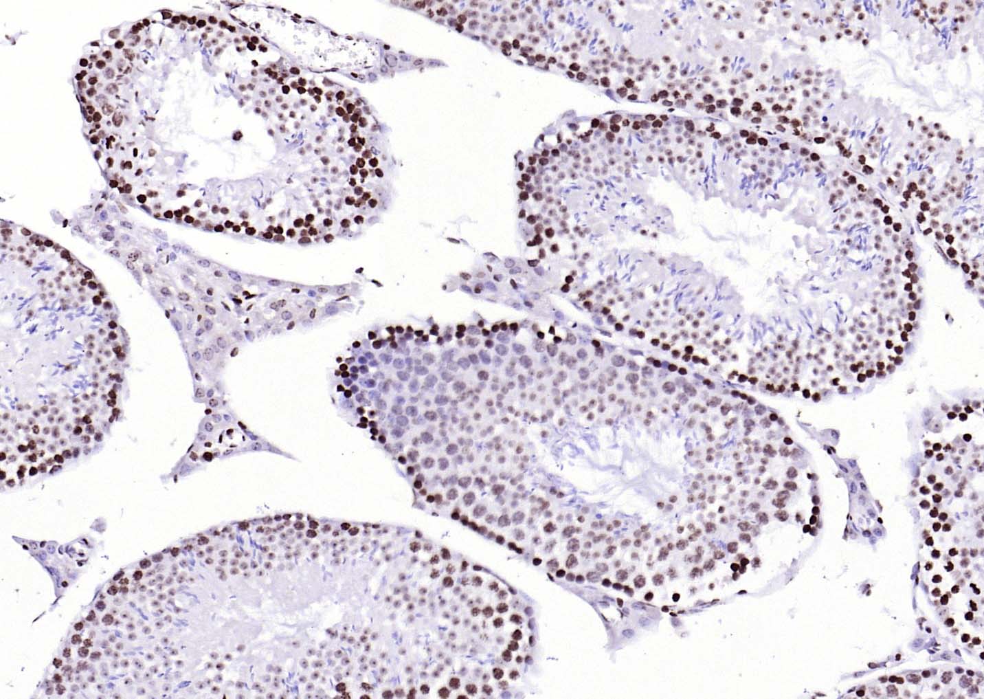 着丝粒蛋白A-bs-2753R