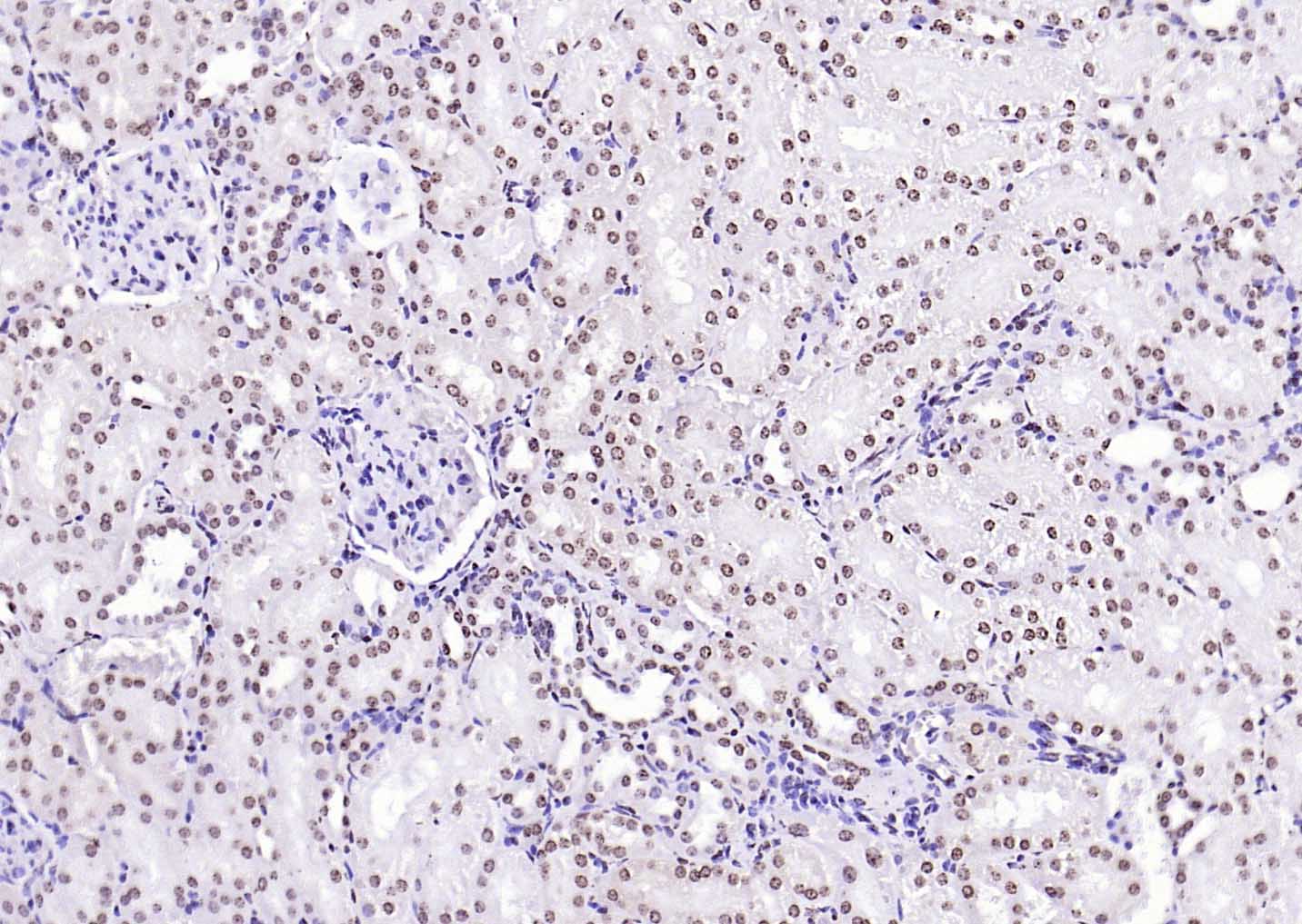 着丝粒蛋白A-bs-2753R